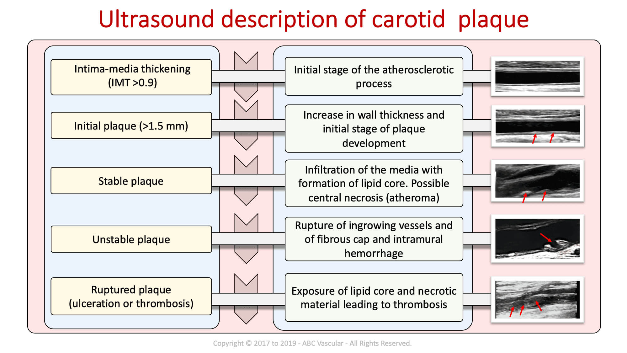 Carotid Course Info | Abc Vascular Pertaining To Carotid Ultrasound Report Template