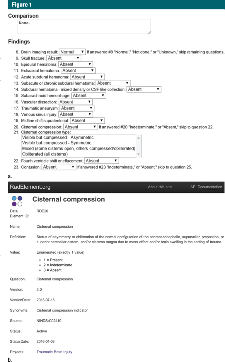 Figure1 Y Report Template Templates Chiropractic Rsna Case for