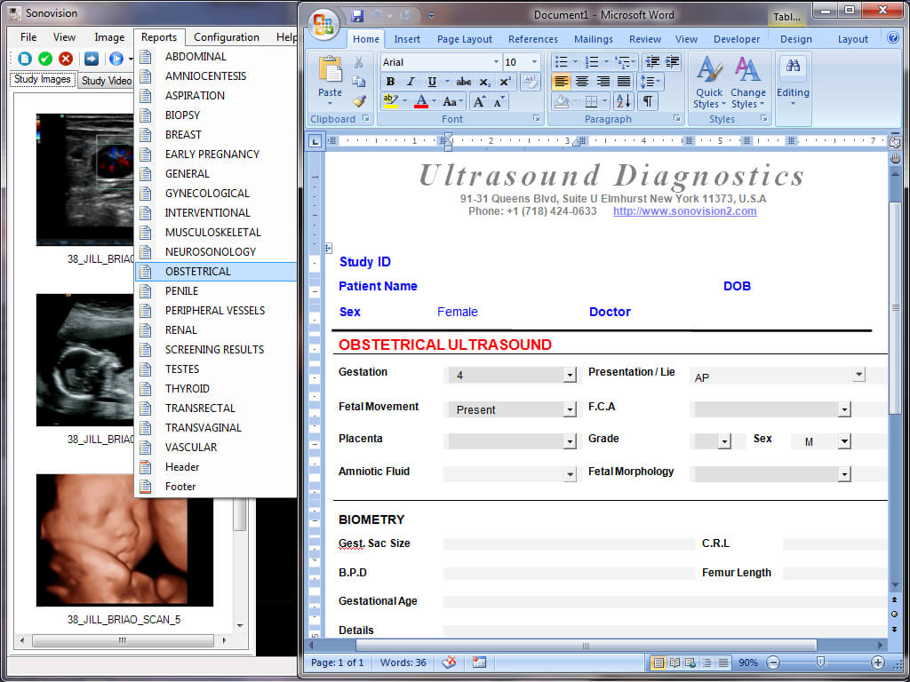 Ultrasound Report Template ] – Ultrasound Technologist With Regard To Carotid Ultrasound Report Template
